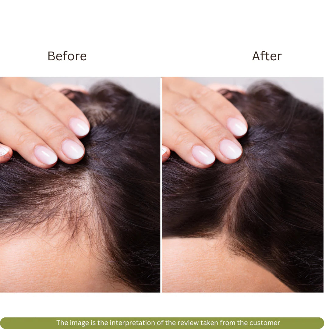 Hair Growth Oil | Reduce Hair Fall